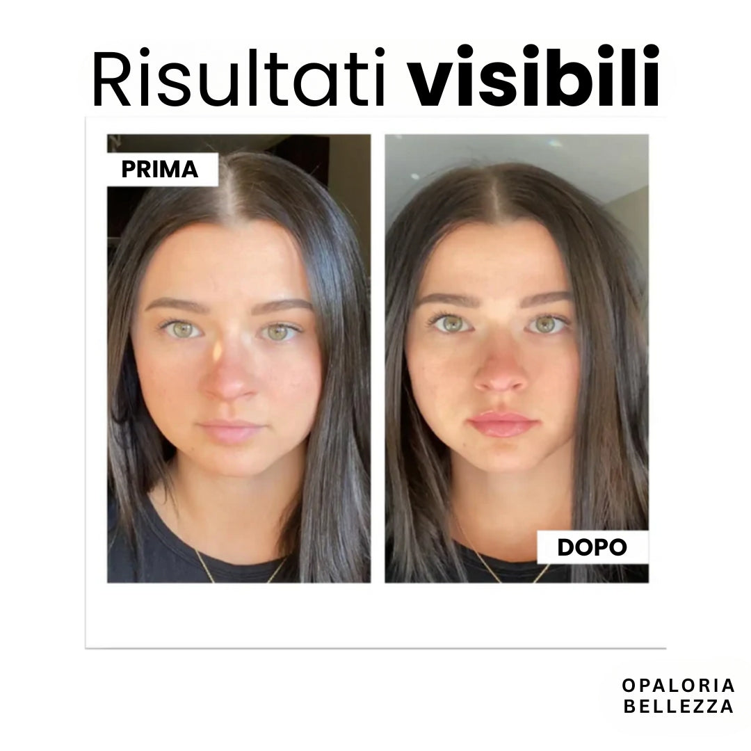 VoluLips - kit professionale per volumizzare le labbra. ®