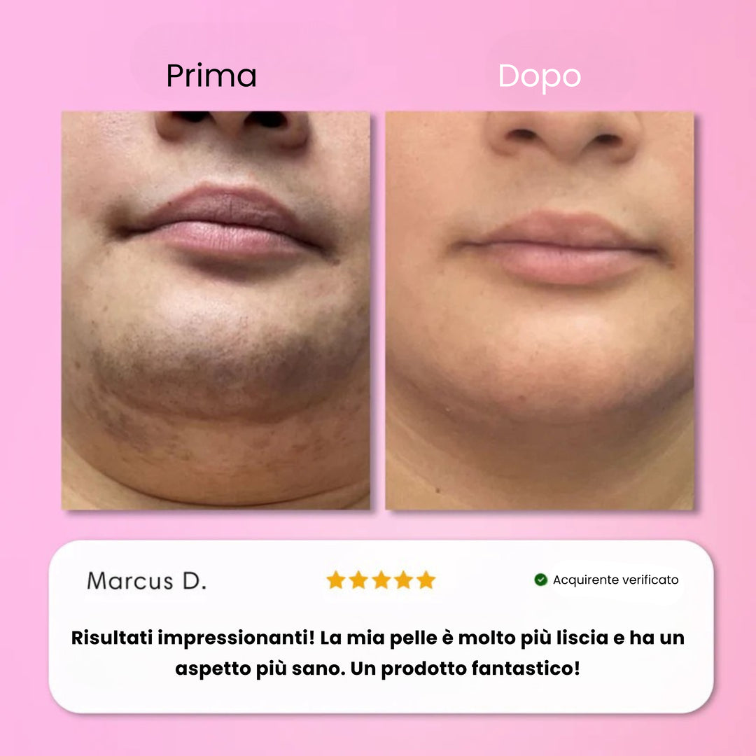 Kit per la depilazione istantanea