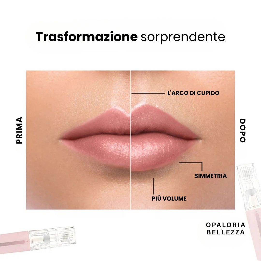 VoluLips - kit professionale per volumizzare le labbra. ®
