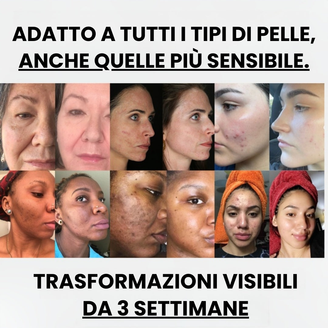 Dischetti di cotone Glow Up - Dischetti di cotone schiarenti con curcuma e acido cogico | 40 dischetti