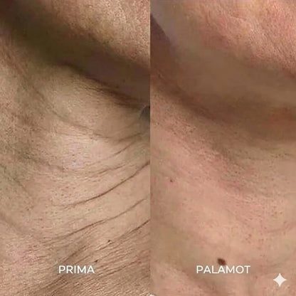 Il sistema di microinfusione™