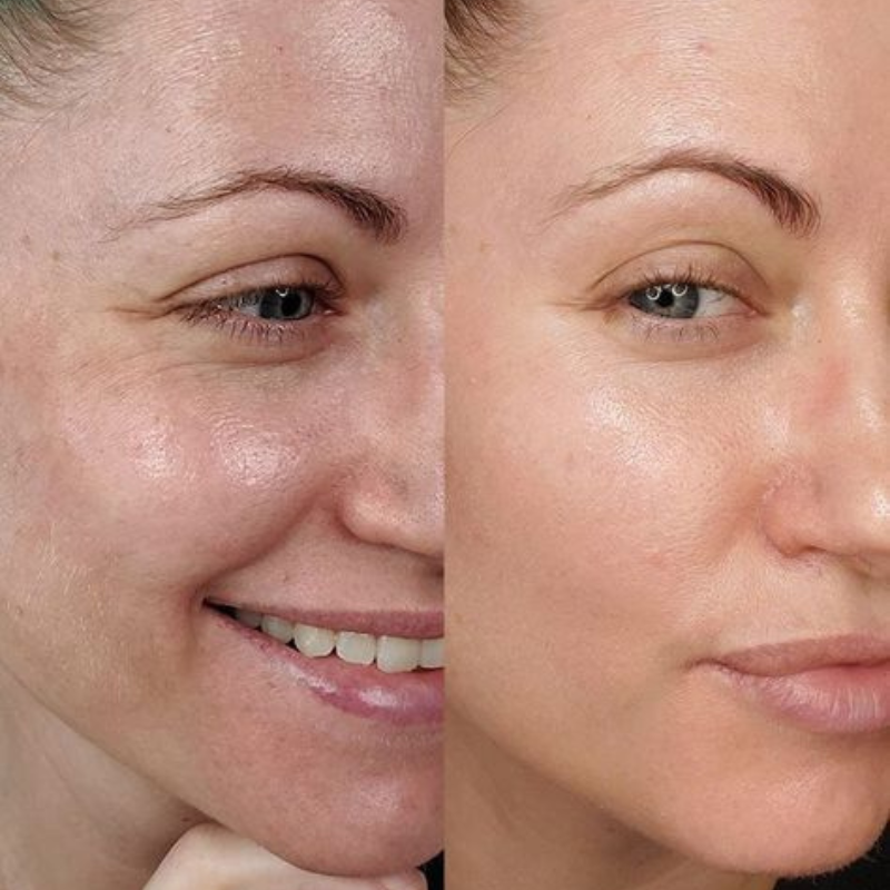 Maschera da notte al collagene Seluna