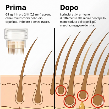 Sistema per la crescita dei capelli Apex
