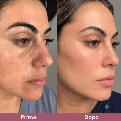 Pori Affinati e Pelle Purificata con Esfoliante al Riso Coreano