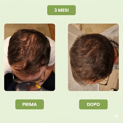 Siero per la crescita dei capelli da uomo