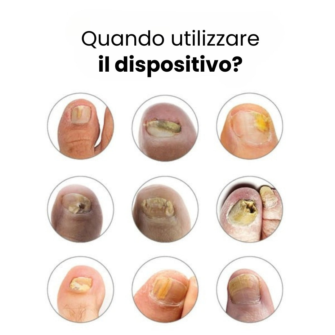 Dispositivo OrthoVital