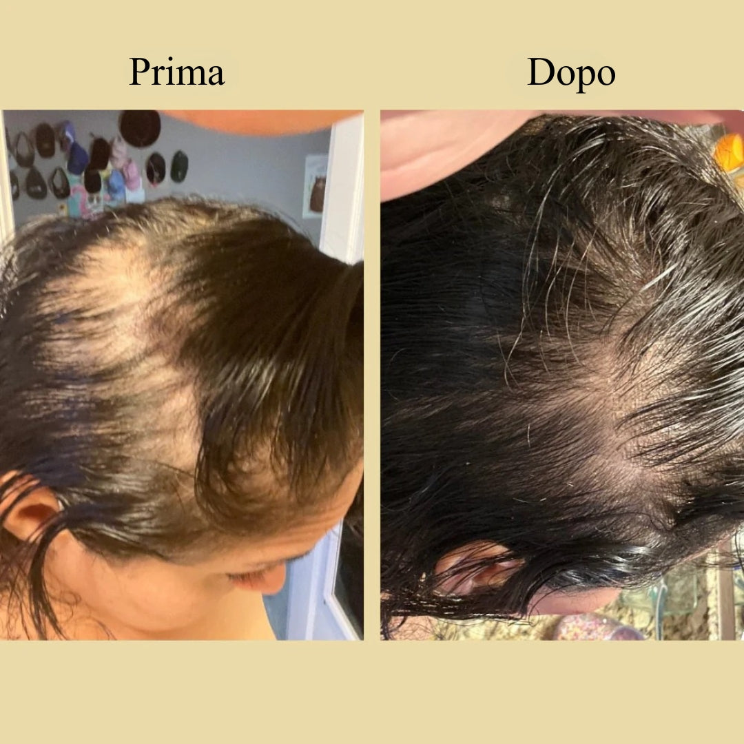 Olio per la crescita naturale dei capelli veganic
