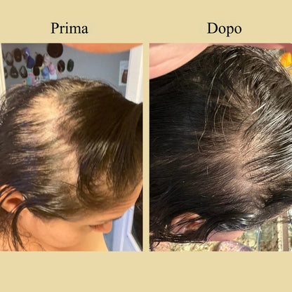 Olio per la crescita naturale dei capelli veganic