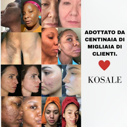 Dischetti di cotone Glow Up - Dischetti di cotone schiarenti con curcuma e acido cogico | 40 dischetti