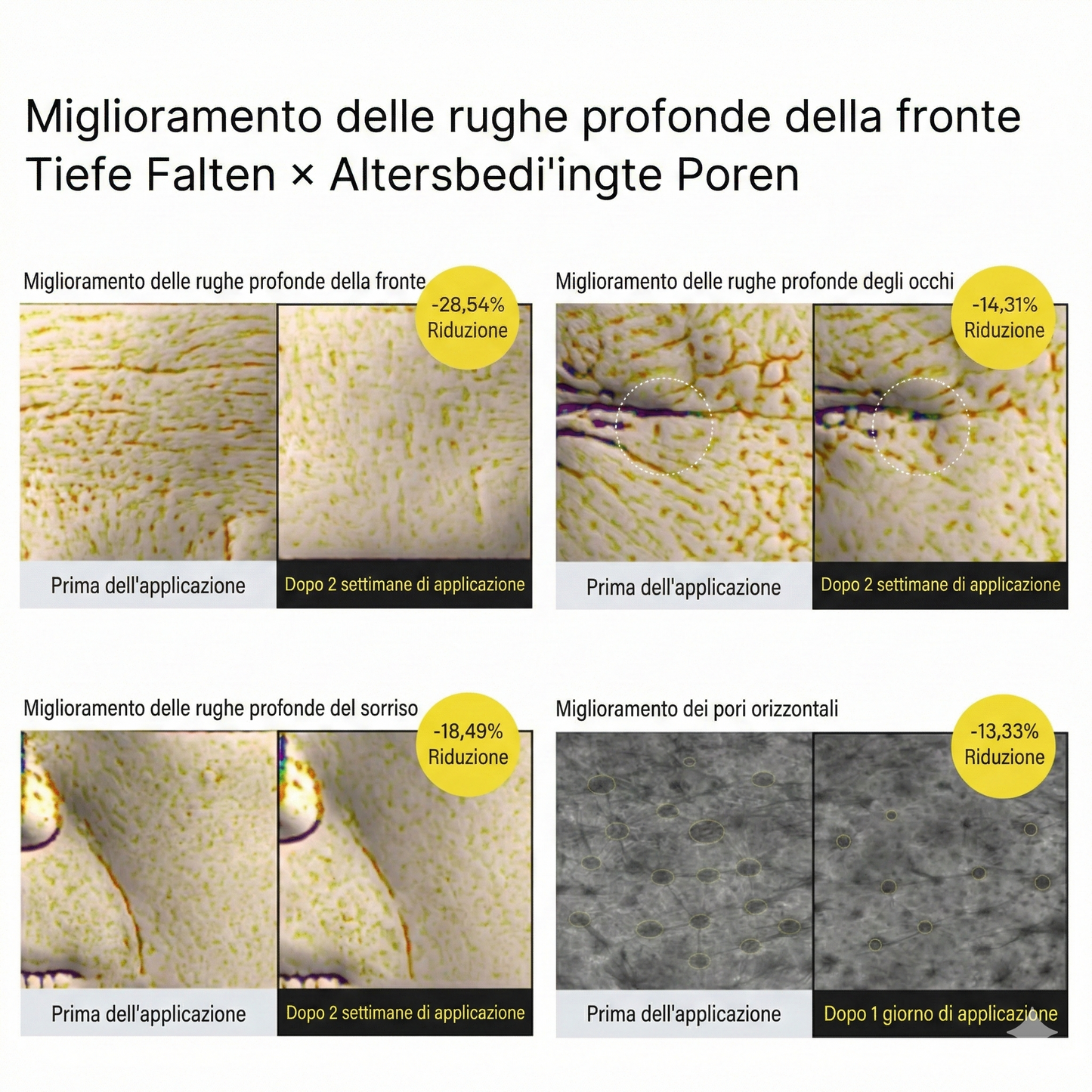 Trattamento rassodante Vita-A