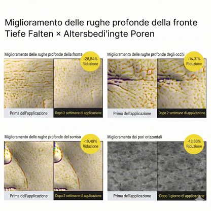 Trattamento rassodante Vita-A