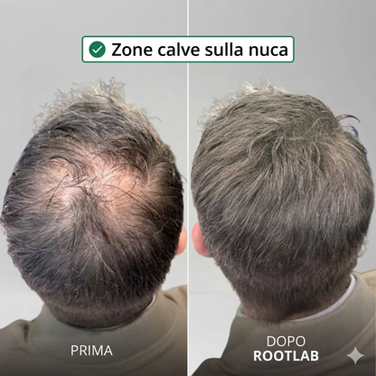 Sistema per la crescita dei capelli Apex