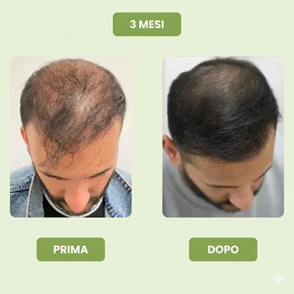 Siero per la crescita dei capelli da uomo