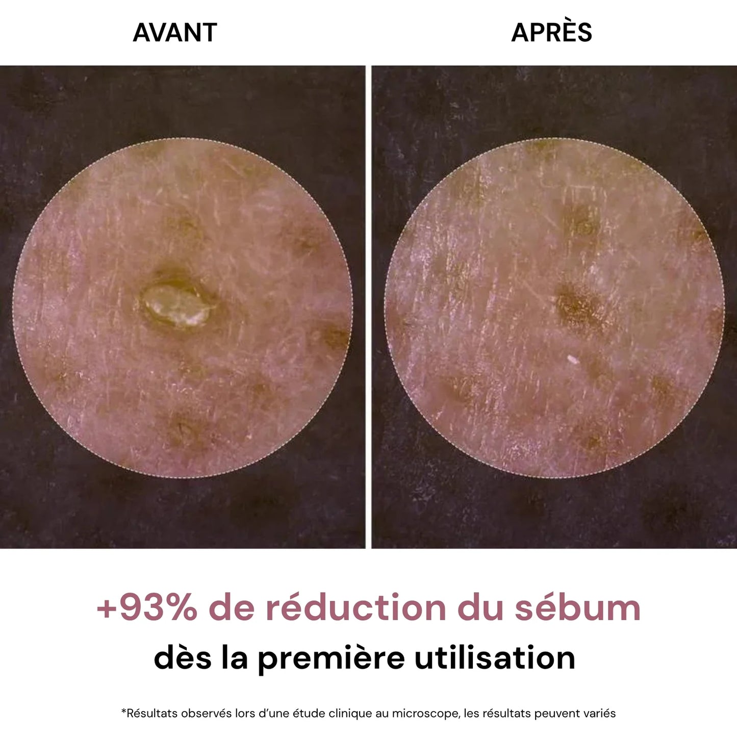 Pori Affinati e Pelle Purificata con Esfoliante al Riso Coreano