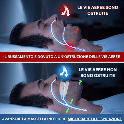ZenSleep ® - Di' addio al russamento e goditi notti tranquille