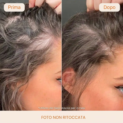 Capelli più lunghi, forti e folti in 6 settimane