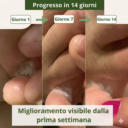 Sapone antimicotico Lyvona