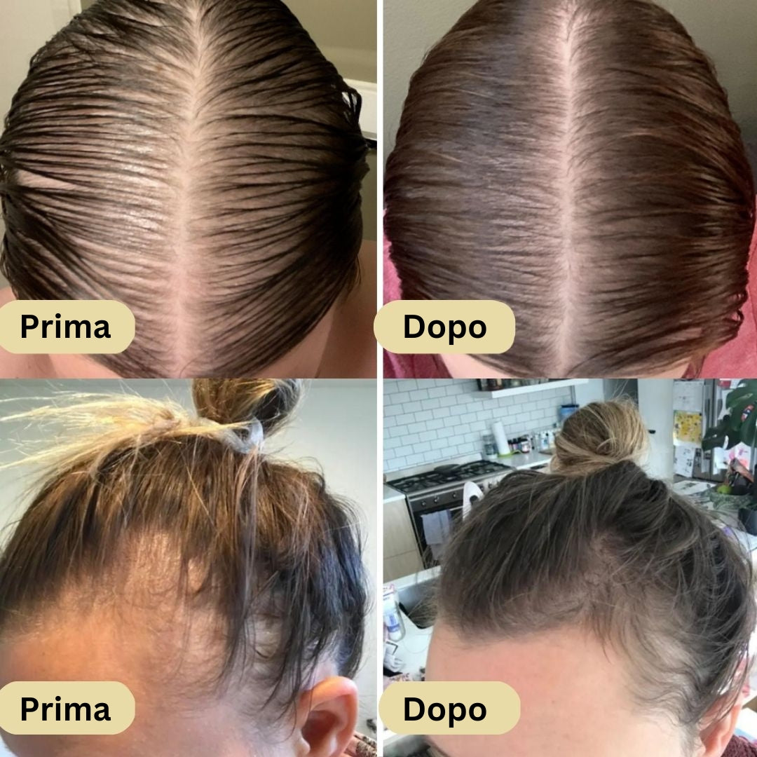 Olio naturale per la crescita dei capelli