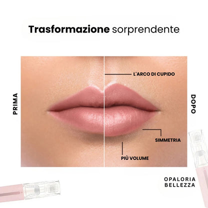 VoluLips - kit professionale per volumizzare le labbra. ®