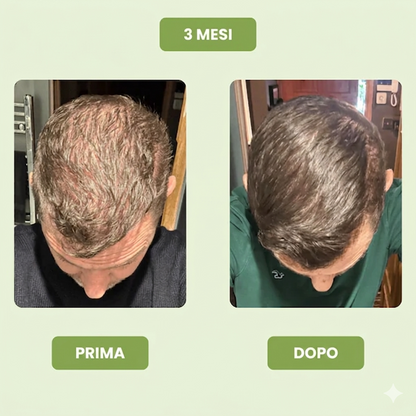 Siero per la crescita dei capelli da uomo