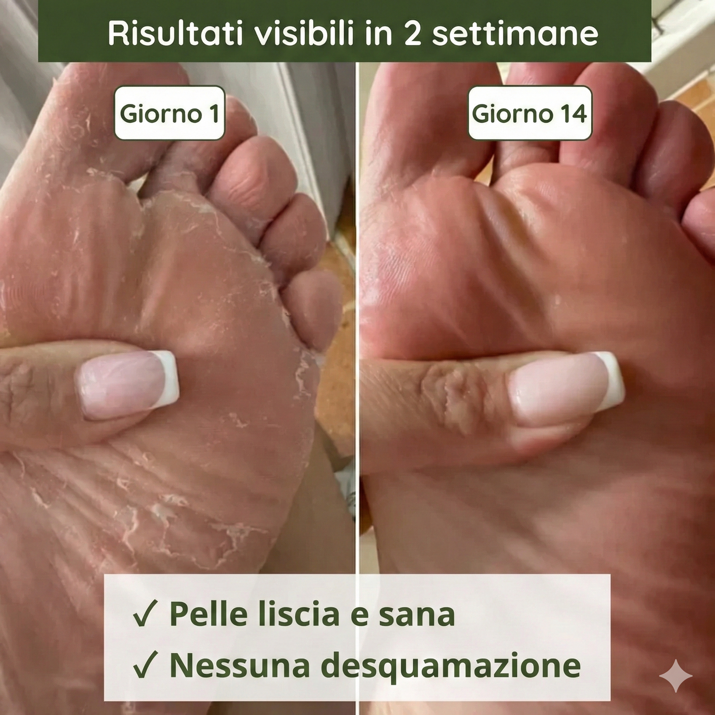 Sapone antimicotico Lyvona