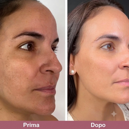 Pori Affinati e Pelle Purificata con Esfoliante al Riso Coreano