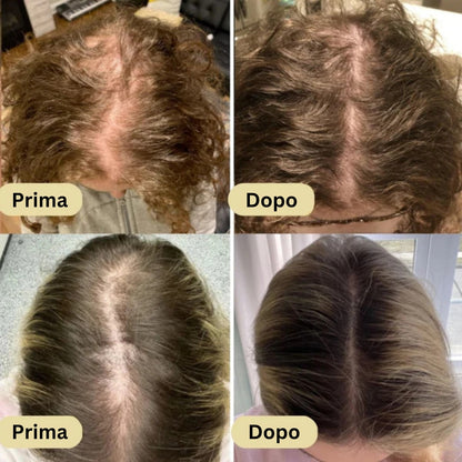 Olio naturale per la crescita dei capelli