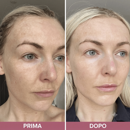 Pori Affinati e Pelle Purificata con Esfoliante al Riso Coreano