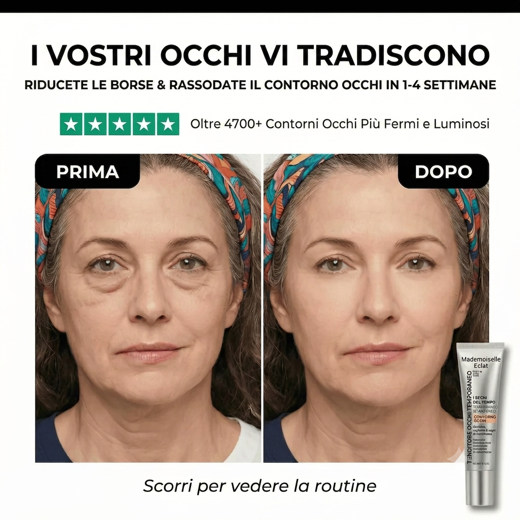 Il trattamento lifting per il contorno occhi di Mademoiselle Éclat