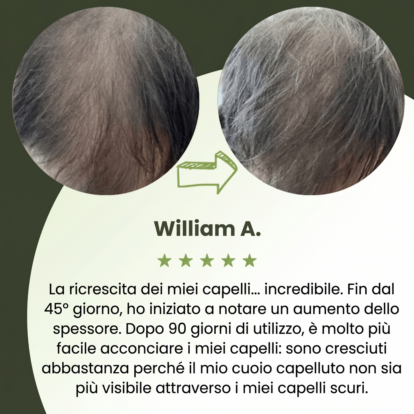 Siero per la crescita dei capelli da uomo