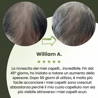 Siero per la crescita dei capelli da uomo