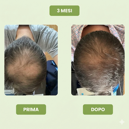 Siero per la crescita dei capelli da uomo