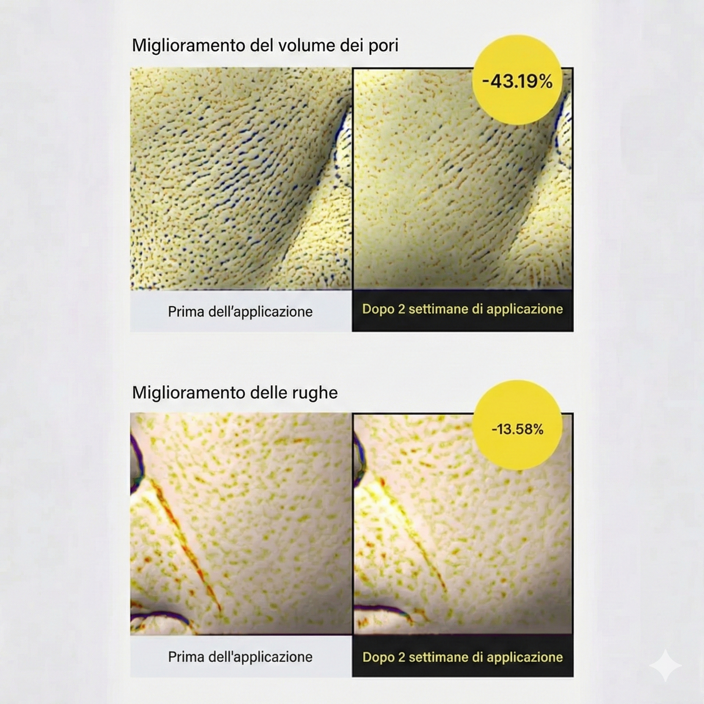 Trattamento rassodante Vita-A