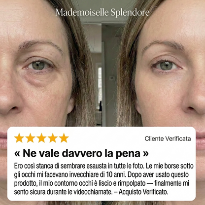 Il trattamento lifting per il contorno occhi di Mademoiselle Éclat