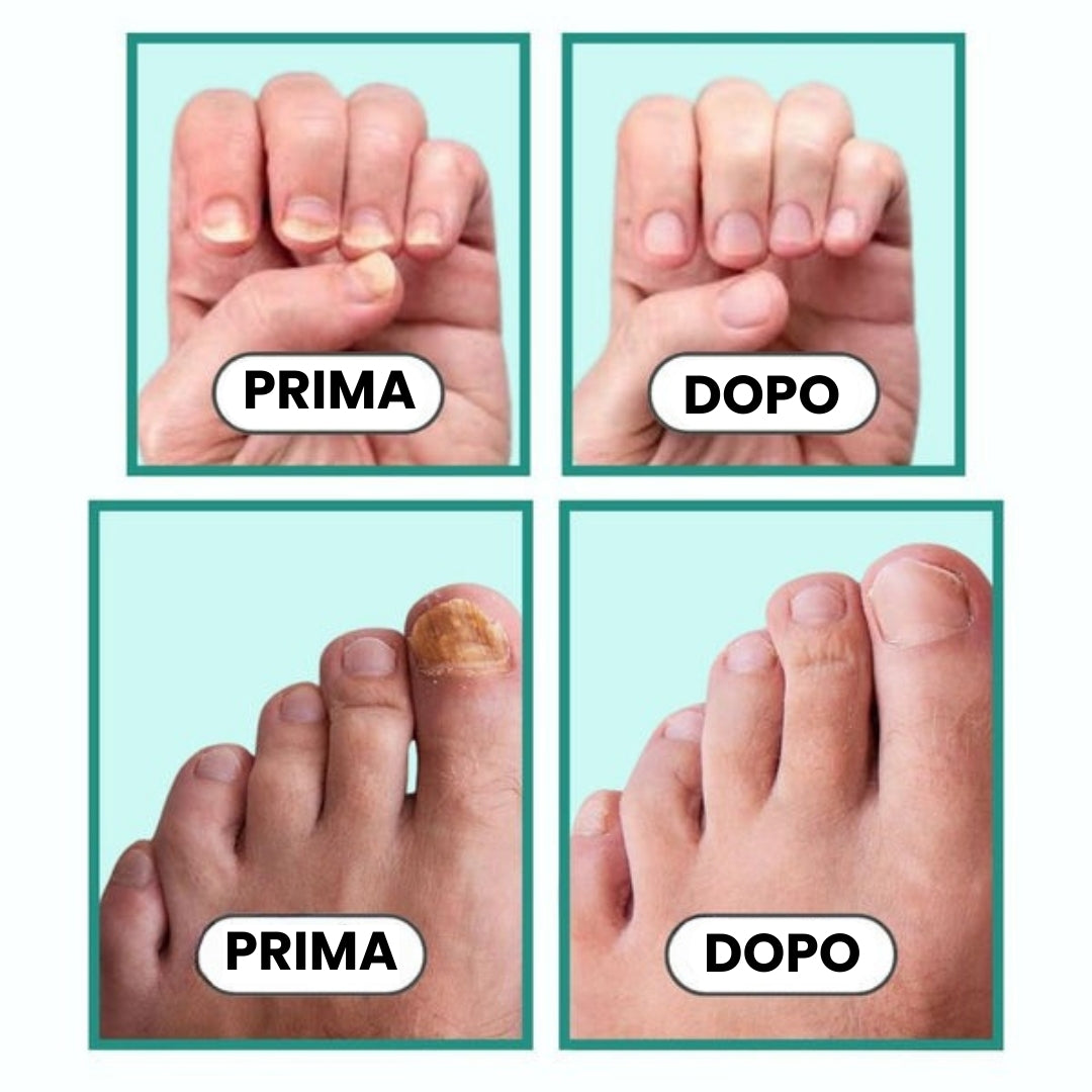 Dispositivo OrthoVital