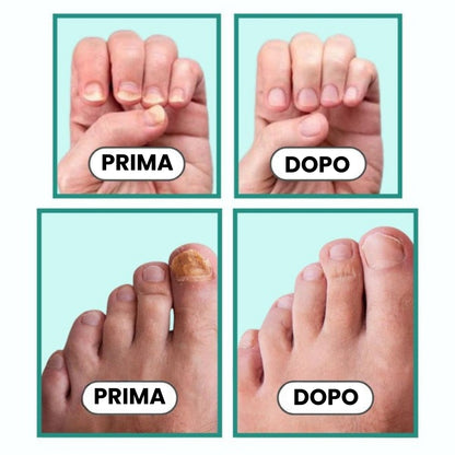 Dispositivo OrthoVital
