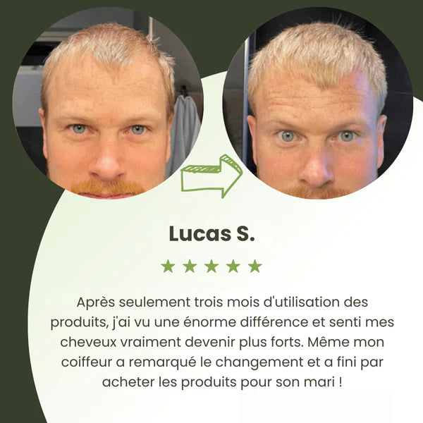 Siero per la crescita dei capelli da uomo