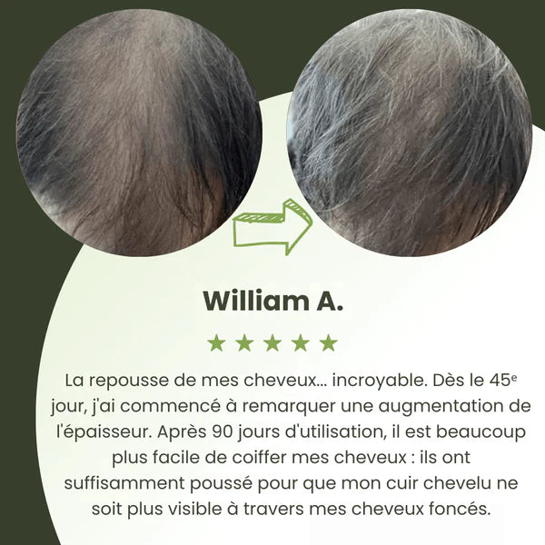 Siero per la crescita dei capelli da uomo