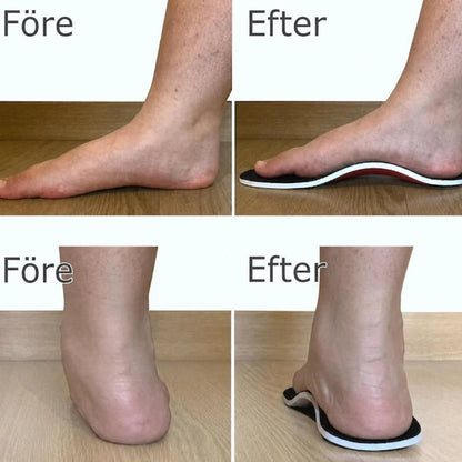 PalamotStep™ – Per chi vuole camminare più a lungo con meno dolore