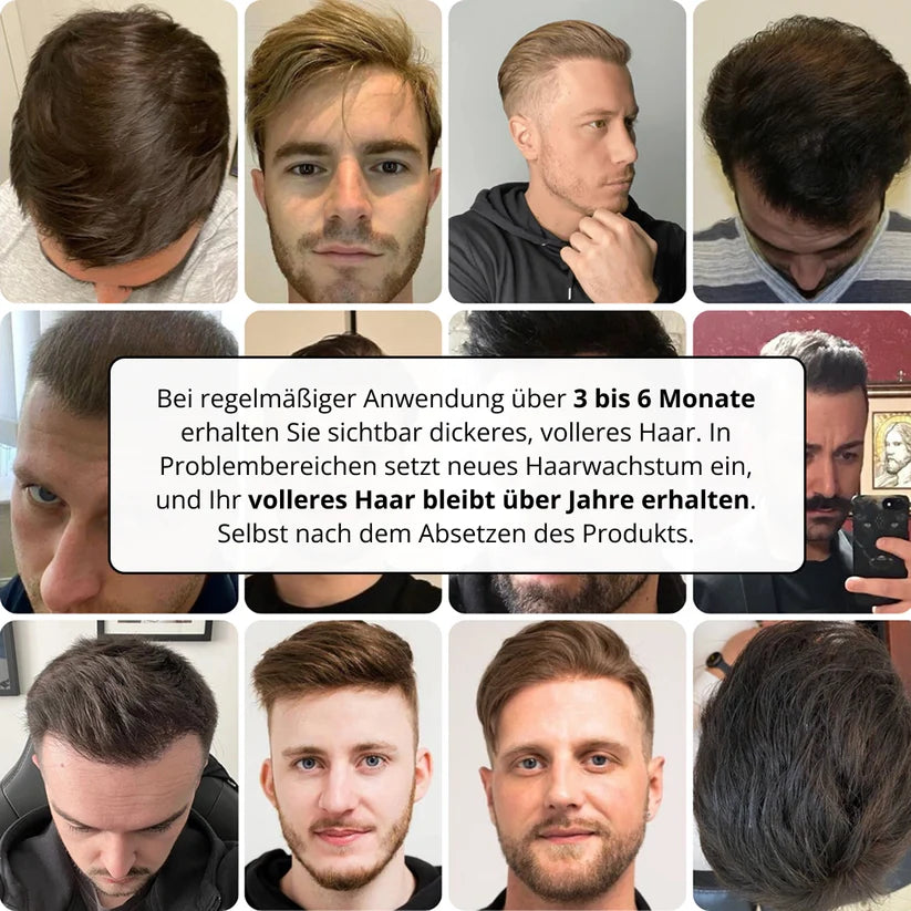Sistema per la crescita dei capelli Apex