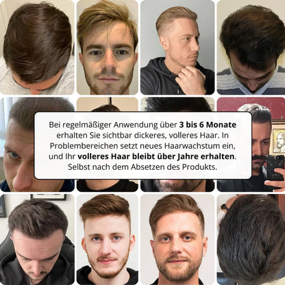 Sistema per la crescita dei capelli Apex
