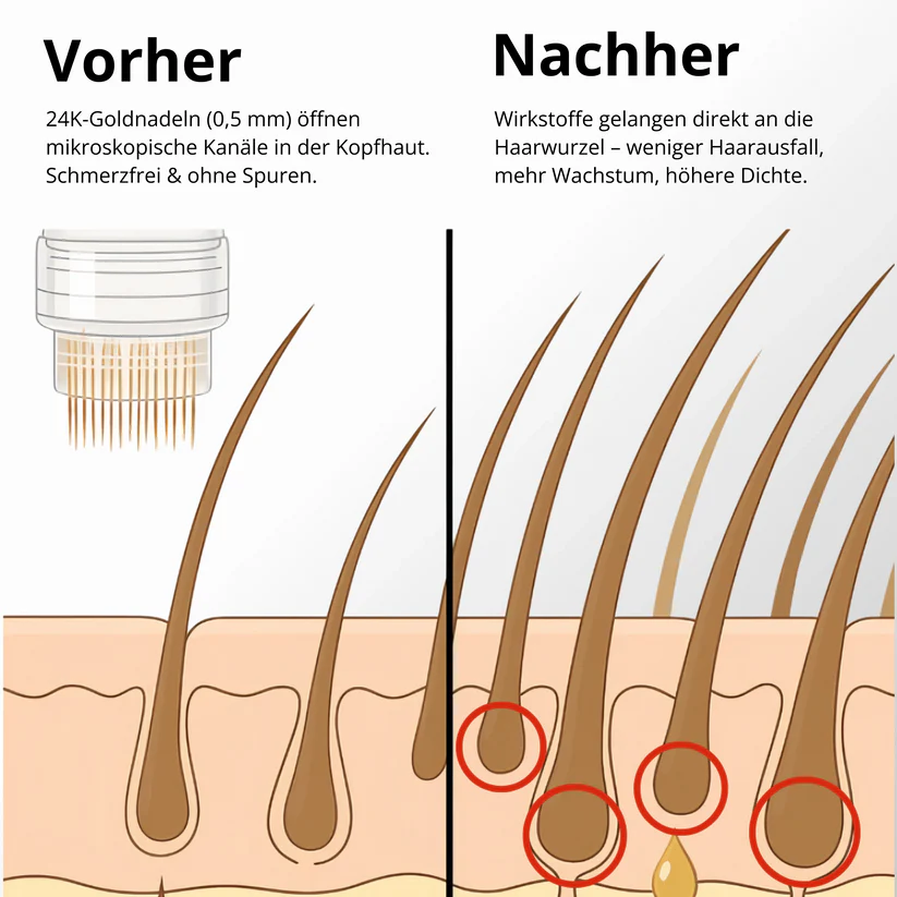 Sistema per la crescita dei capelli Apex