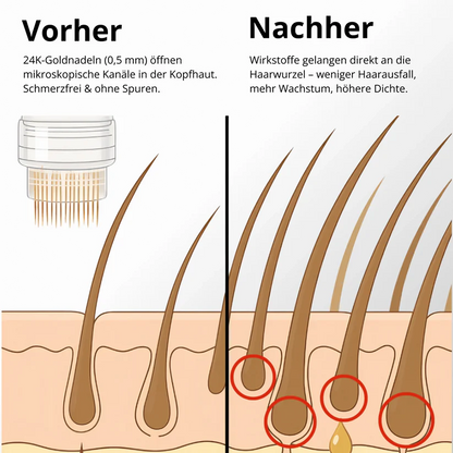 Sistema per la crescita dei capelli Apex