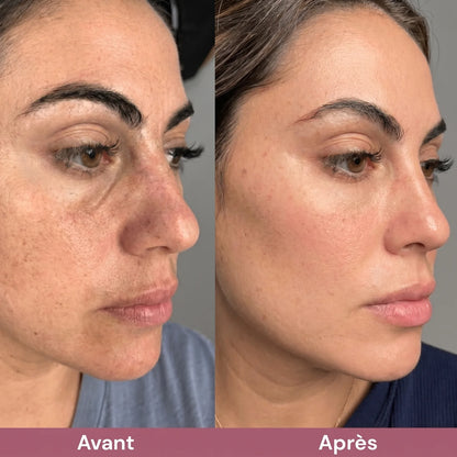Pori Affinati e Pelle Purificata con Esfoliante al Riso Coreano