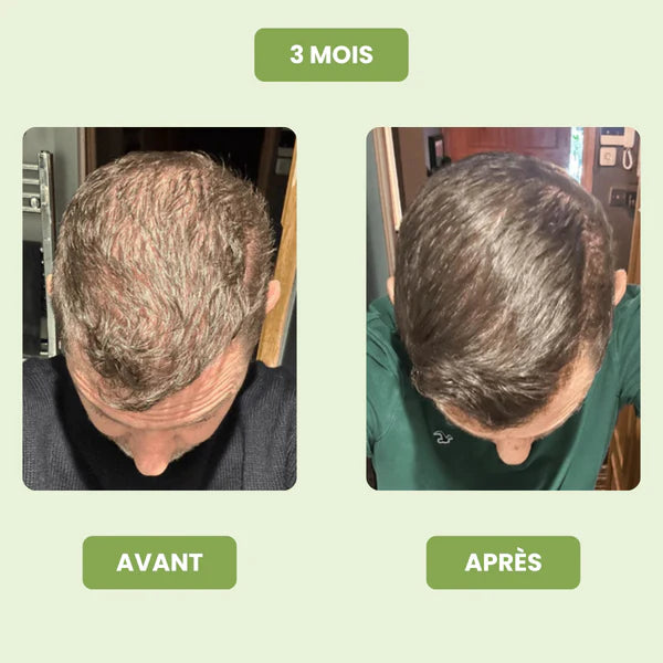 Siero per la crescita dei capelli da uomo
