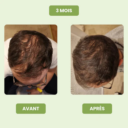 Siero per la crescita dei capelli da uomo