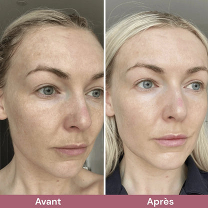 Pori Affinati e Pelle Purificata con Esfoliante al Riso Coreano