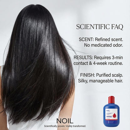 Controllo Olio Shampoo Antiforfora Delicato con Selenium