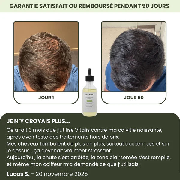 Siero per la crescita dei capelli da uomo