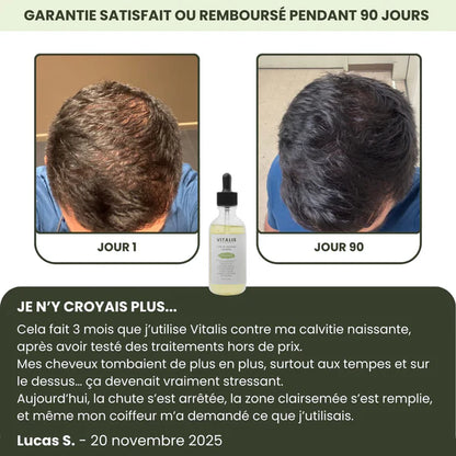 Siero per la crescita dei capelli da uomo